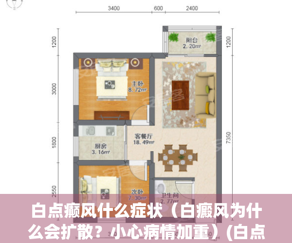 白点癫风什么症状（白癜风为什么会扩散？小心病情加重）(白点癫风早期症状治疗)