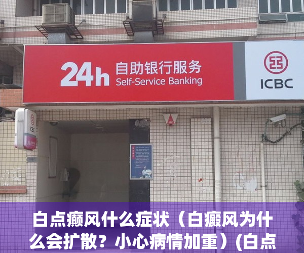 白点癫风什么症状（白癜风为什么会扩散？小心病情加重）(白点癫风怎么形成的)