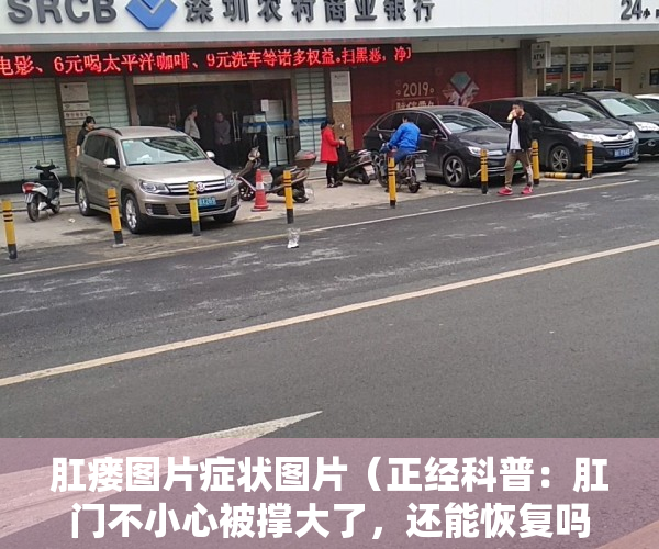 肛瘘图片症状图片（正经科普：肛门不小心被撑大了，还能恢复吗？万一卡住了怎么办？）