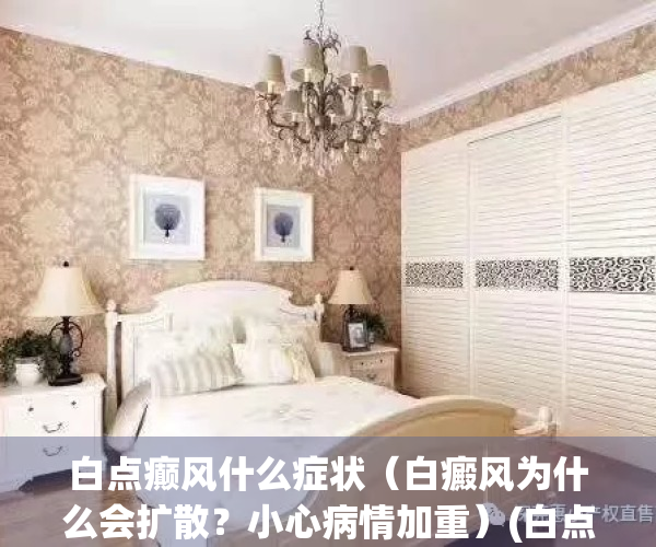 白点癫风什么症状（白癜风为什么会扩散？小心病情加重）(白点癫风是什么病)